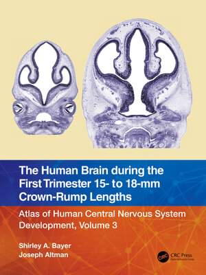 cover image of The Human Brain during the First Trimester 15- to 18-mm Crown-Rump Lengths: Atlas of Human Central Nervous System Development, Volume 3